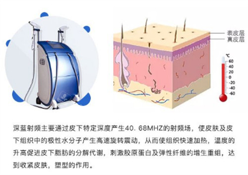 深蓝射频的功效与原理图解