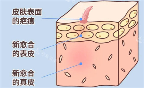 南京疤痕疙瘩医院排名前三：美莱、康美、伊菲斯祛疤痕口碑好！