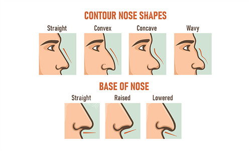 可以进行鼻整形的各类鼻型