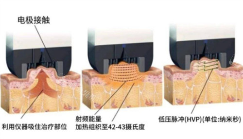 钻石超塑的原理图解