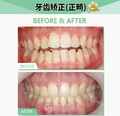 江南SMILE VIEW牙科對比圖