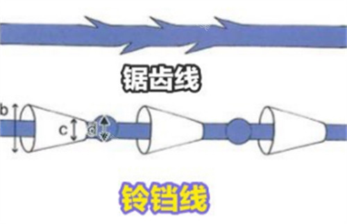 韩国铃铛线提升术后提拉感强吗?韩国madeu皮肤科的朴在友医生为你解答!