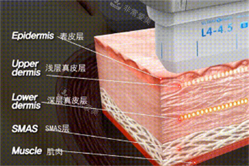 不同肌肤层次图解 不同肌肤层次图解