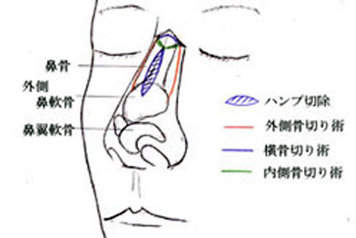 鼻部构成图解