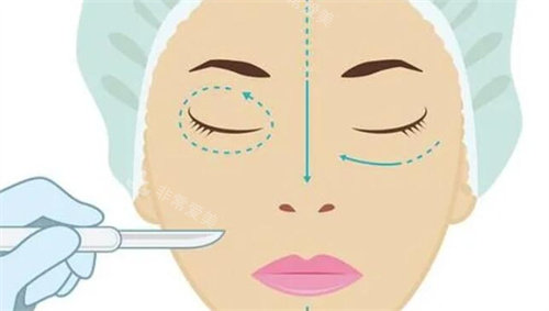 整形手术动画图