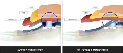 不同层次韧带展示