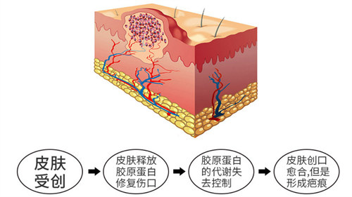 皮肤修复过程图示
