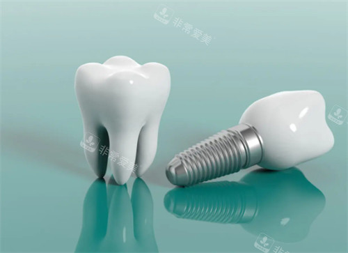 种植牙和正产牙齿的区别图解