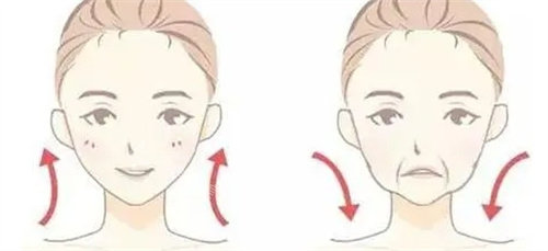 面部提升动画图