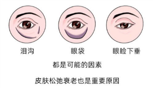 眼部衰老問(wèn)題圖解