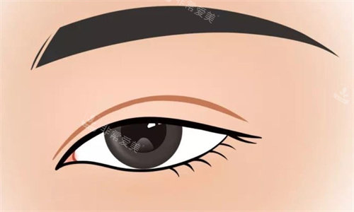 双眼皮动画图