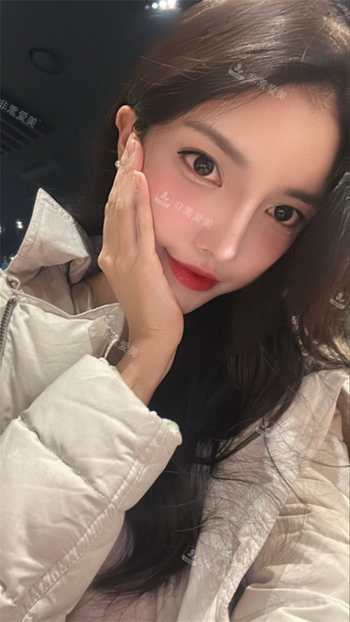 韓國(guó)DL整形外科術(shù)后 韓國(guó)DL整形外科術(shù)后