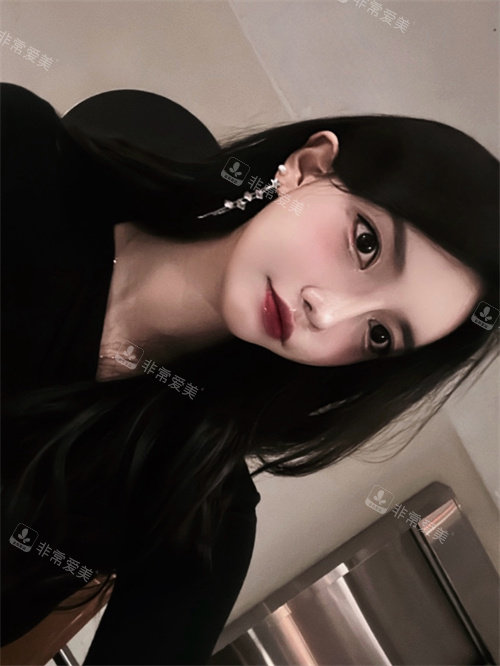 韓國(guó)DL整形外科鼻整形對(duì)比圖 韓國(guó)DL整形外科鼻整形對(duì)比圖