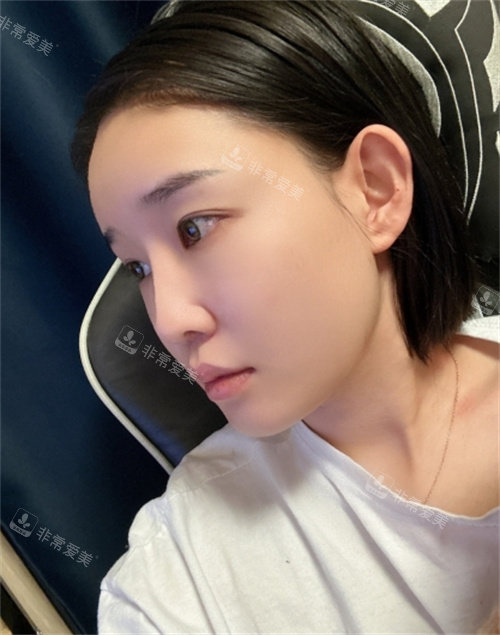 韓國DL整形外科真人術(shù)前生活側(cè)面照 韓國DL整形外科真人術(shù)前生活側(cè)面照