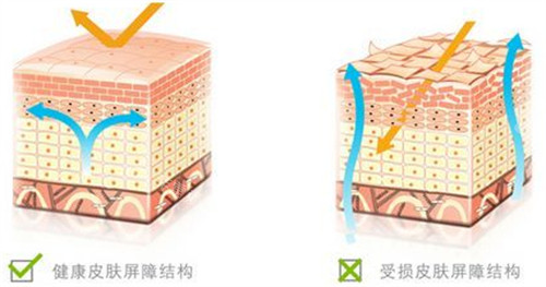 舒敏之星治疗前后皮肤屏障对比图
