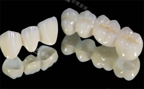 全瓷牙冠的样子图片