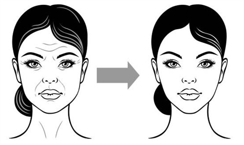 面部提升手术改善皮肤皱纹
