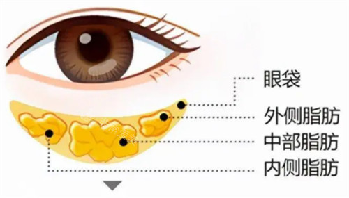 眼袋的构成图解