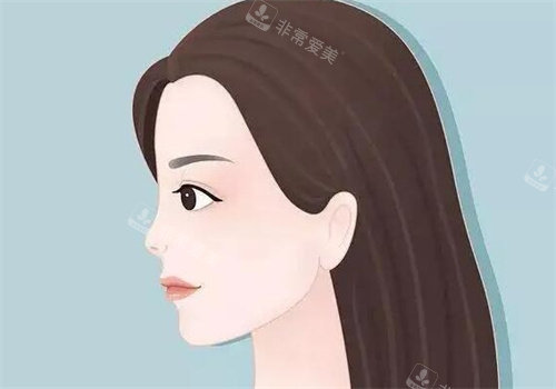 隆鼻动画图