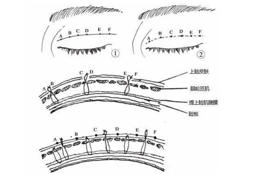 眼皮結(jié)構(gòu)組織圖