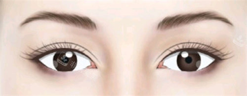双眼皮动画图