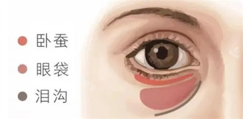 祛眼袋动画图