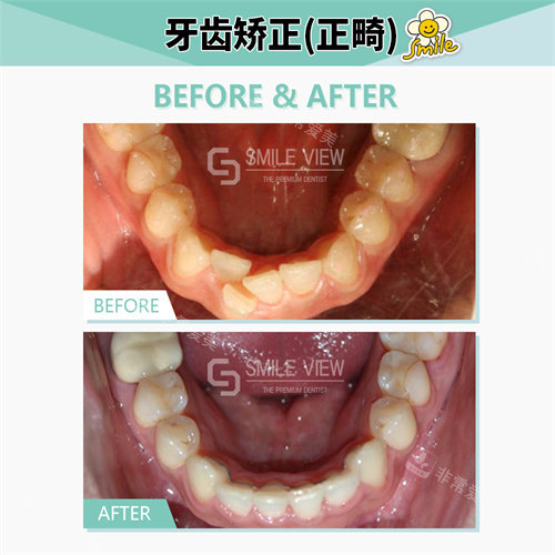 江南SmileView牙科牙齒矯正 江南SmileView牙科牙齒矯正
