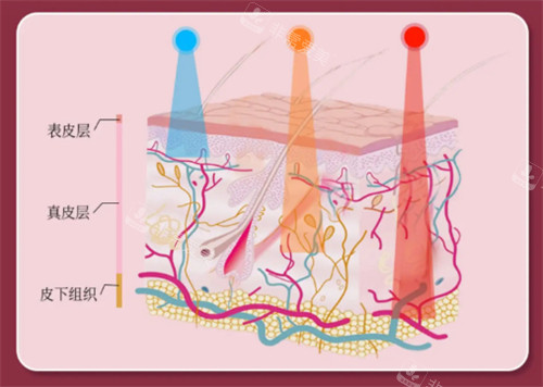 不同波長(zhǎng)對(duì)皮膚作用層次不同