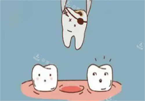 牙科拔牙过程图解
