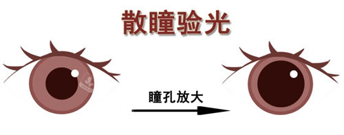 散瞳验光