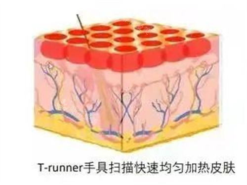 火凤凰溶脂加热过程图解