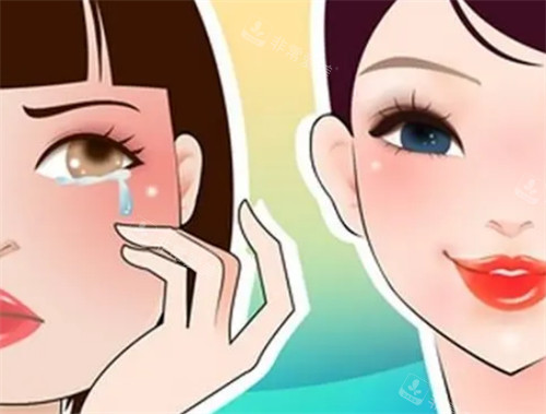 Belkyra碎脂针瘦脸前后对比图