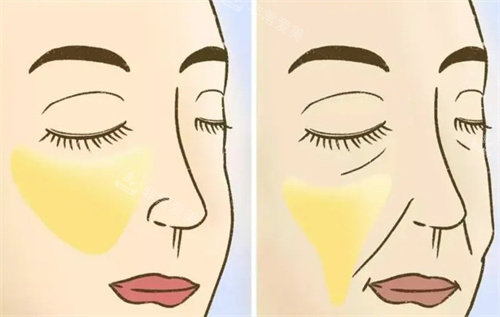 韩国人认可的jiwoo皮肤科，即刻有效的Eravity面部提升了解一下！
