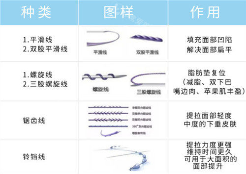 埋線提升不同的線材