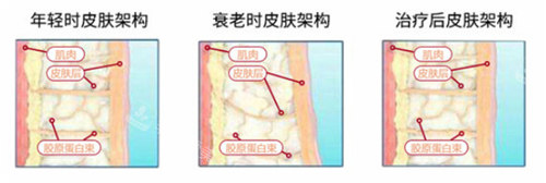 不同的皮膚狀態(tài)對(duì)比