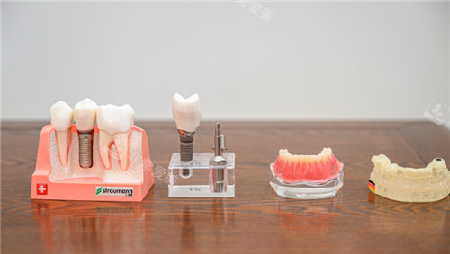 不同牙齿模型展示