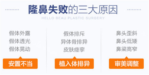 隆鼻失敗的原因 隆鼻失敗的原因