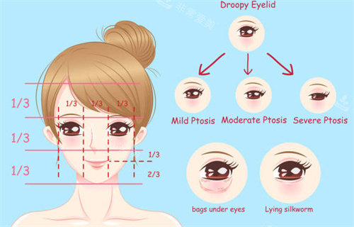 双眼皮设计方案一览图片