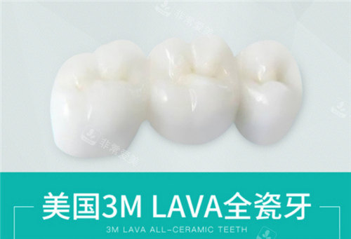 美国3M LAVA全瓷牙