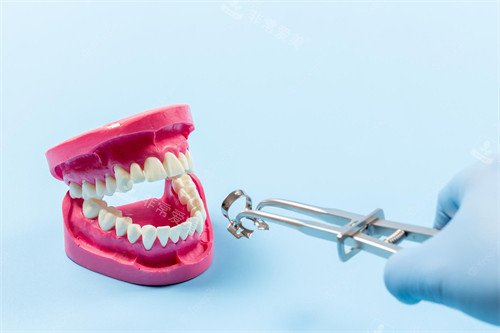 牙齿治疗动画图示