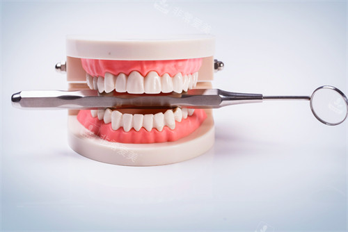 牙齿模型图示