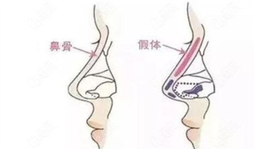 韩国Noselips整形外科官网_联系电话_地址_官网提前预约方便快捷