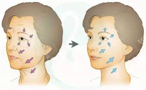 ​韩国面部抗衰技术真绝，分享我在韩国的面部抗衰经历真的很减龄！