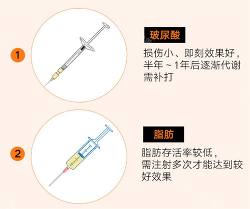 玻尿酸和脂肪隆鼻优势