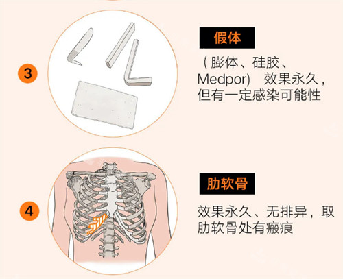 假體和肋軟骨隆鼻材料