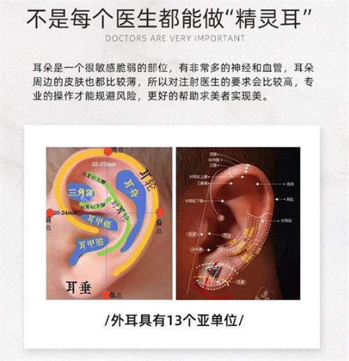 精灵耳的注射部位图示