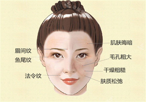 面部埋线可改善的位置图解