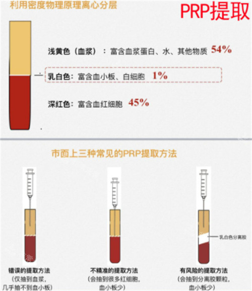 丽芙莎高潮针的原理介绍