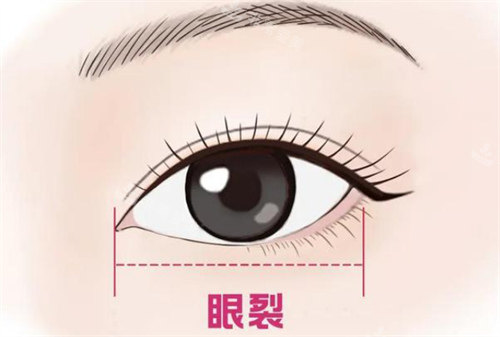 韩国做眼睛比中国好吗?我在国内修复3次的眼睛到韩国修复好了!