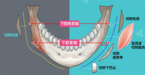 下颌各个部位展示